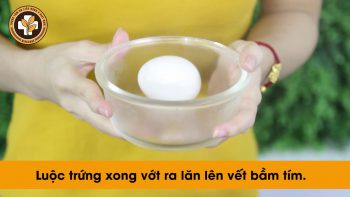 MẸO HAY THỔI BAY VẾT BẦM TÍM CHỈ TRONG 1 NỐT NHẠC