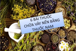 6 bài thuốc trị vảy nến bằng thuốc nam