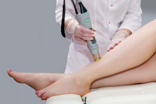 Điều trị viêm nang lông bằng phương pháp laser