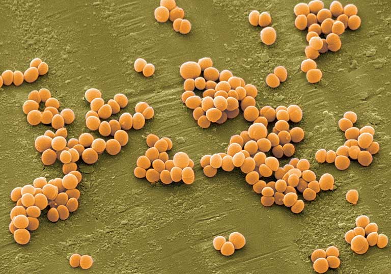 Vi khuẩn Staphylococcus làm nhiễm trùng và phát sinh mụn nhọt không có đầu
