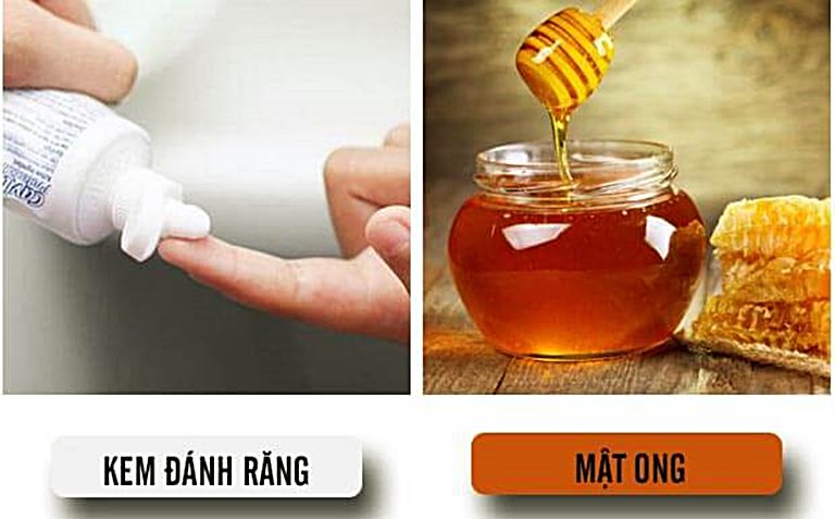 Kem đánh răng kết hợp với mật ong để trị tàn nhang rất hiệu quả