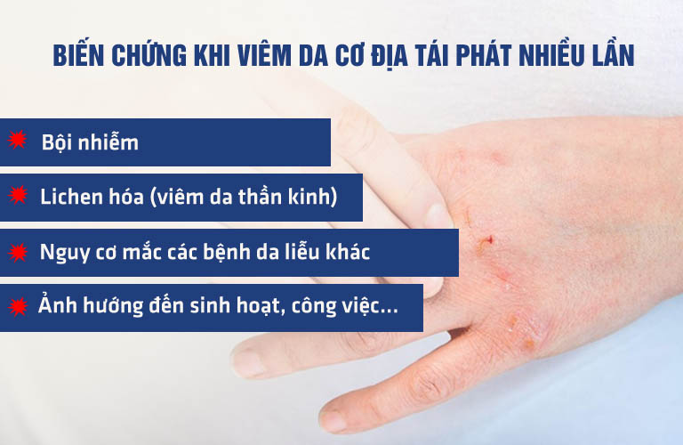 Các biến chứng của viêm da cơ địa nếu bệnh tái phát nhiều lần