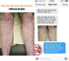 Kết quả khiến cho chị Mai Anh rất hài lòng