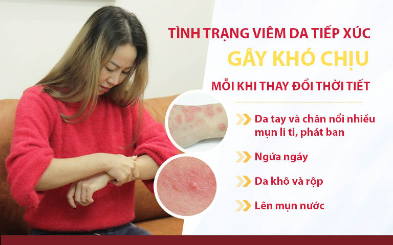 Những triệu chứng viêm da tiếp xúc khiến nữ diễn viên khó chịu