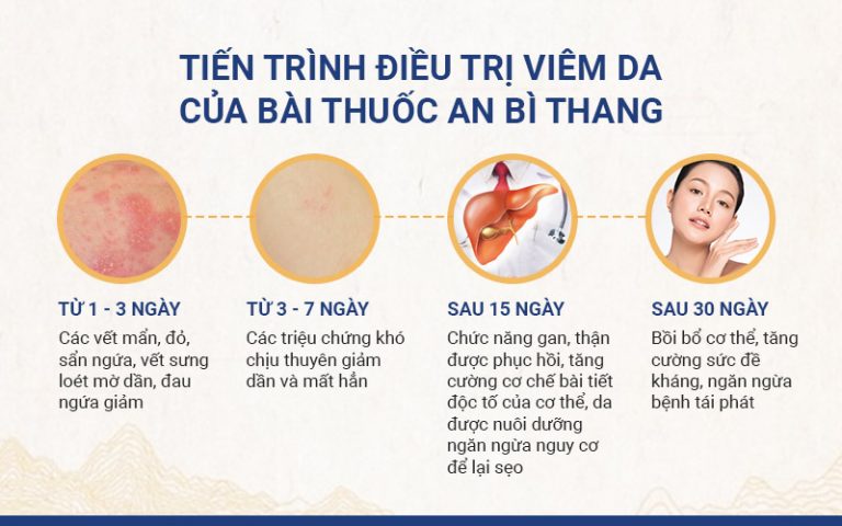 Các triệu chứng mề đay giảm nhanh chóng theo đúng liệu trình mà bác sĩ đã đưa ra