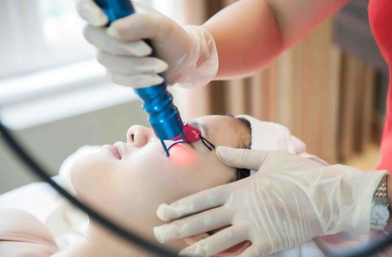 Phương pháp laser cũng không thể giúp chị Thu hết nám