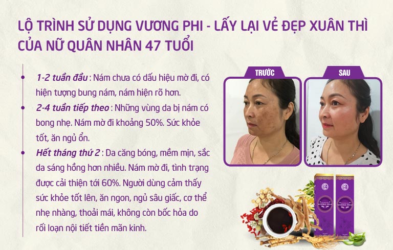 Lộ trình một trường hợp thông thường sử dụng giải pháp xử lý nám, tàn nhang Vương Phi