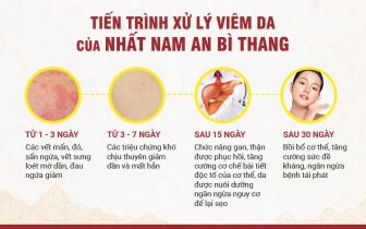 Phác đồ điều trị viêm da dầu chung