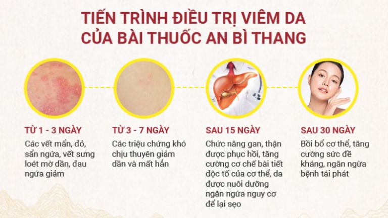 tiến trình điều trị của nhất nam an bì thang